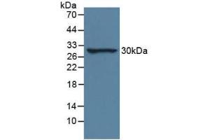 Western blot analysis of Rat Lung Tissue. (IL-33 anticorps  (AA 112-270))