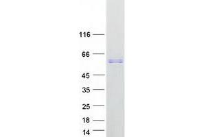 Validation with Western Blot