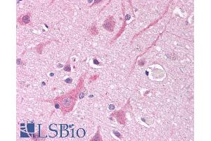 ABIN185467 (10µg/ml) staining of paraffin embedded Human Cortex. (SCN5A anticorps  (Internal Region))