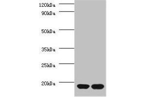 Western blot All lanes: RPS13 antibody at 2 μg/mL Lane 1: EC109 whole cell lysate Lane 2: 293T whole cell lysate Secondary Goat polyclonal to rabbit IgG at 1/15000 dilution Predicted band size: 18 kDa Observed band size: 18 kDa (RPS13 anticorps  (AA 3-151))