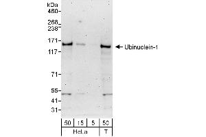 anti-Ubinuclein 1 (UBN1) (AA 1084-1134) antibody