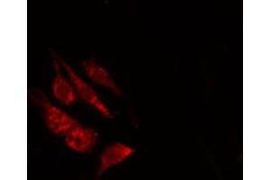 ABIN6278618 staining Hela by IF/ICC. (OR8B2/B3 anticorps)