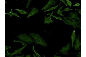 Immunofluorescence of monoclonal antibody to PLS3 on HeLa cell. (Plastin 3 anticorps  (AA 1-630))