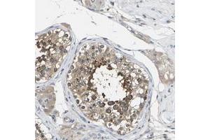 Immunohistochemical staining of human testis with TMCC2 polyclonal antibody  shows strong cytoplasmic positivity in cells in seminiferus ducts. (TMCC2 anticorps)