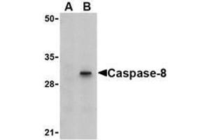 Western blot analysis of Caspase-8 in HT-29 cell lysate with AP30204PU-N Caspase-8 antibody (IN) at 1 μg/ml in (A) the presence or (B) the absence of blocking peptide. (Caspase 8 anticorps)
