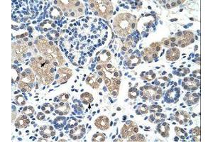 Image no. 1 for anti-Nuclear Receptor Subfamily 2, Group F, Member 2 (NR2F2) (AA 141-190) antibody (ABIN6736209)