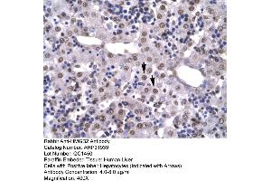 Human Liver (HMGB2 anticorps  (C-Term))