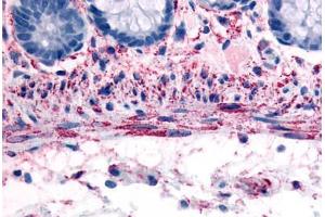 Human Smooth Muscle Cells (formalin-fixed, paraffin-embedded) stained with ADRA1B antibody ABIN213529 at 10 ug/ml followed by biotinylated goat anti-rabbit IgG secondary antibody ABIN481713, alkaline phosphatase-streptavidin and chromogen. (ADRA1B anticorps  (C-Term))