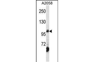 Western blot analysis in A2058 cell line lysates (35ug/lane).