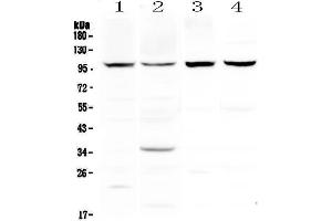 Western blot analysis of DYRK1A using anti-DYRK1A antibody .