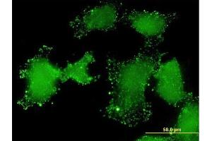 Immunofluorescence of monoclonal antibody to LSM3 on HeLa cell.