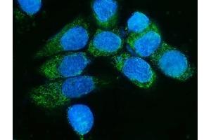 IF analysis of TIMM8A/DDP using anti-TIMM8A/DDP antibody (ABIN7600039). (TIMM8A/DDP anticorps  (AA 14-97))