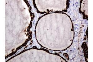 Image no. 12 for anti-Pogo Transposable Element with KRAB Domain (POGK) antibody (ABIN1500329)