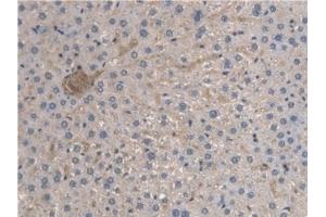 Detection of ARNTL in Rat Liver Tissue using Polyclonal Antibody to Aryl Hydrocarbon Receptor Nuclear Translocator Like Protein (ARNTL)