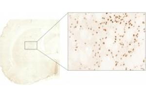 Immunohistochemistry (IHC) image for anti-Huntingtin (HTT) (AA 85-200) antibody (ABIN6254174)