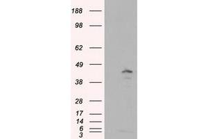 Image no. 1 for anti-Induced Myeloid Leukemia Cell Differentiation Protein Mcl-1 (MCL1) antibody (ABIN1499342)