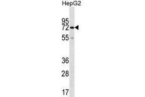 CTPS2 Antibody (C-term) western blot analysis in HepG2 cell line lysates (35µg/lane). (CTPS2 anticorps  (C-Term))
