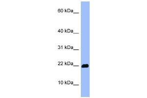 OMP antibody used at 1 ug/ml to detect target protein. (OMP anticorps  (Middle Region))