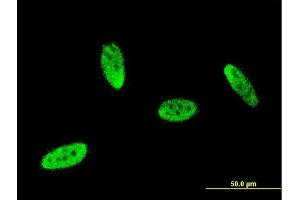 Immunofluorescence of monoclonal antibody to SOX8 on HeLa cell.