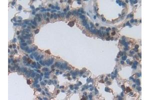 Detection of PLS3 in Mouse Lung Tissue using Polyclonal Antibody to Plastin 3 (PLS3) (Plastin 3 anticorps  (AA 5-251))