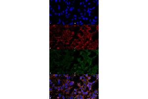Immunocytochemistry/Immunofluorescence analysis using Mouse Anti-4-Hydroxynonenal Monoclonal Antibody, Clone 12F7 . (HNE anticorps  (APC))