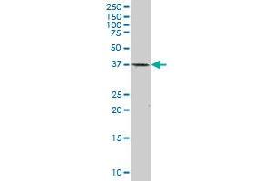 CDX2 monoclonal antibody (M01), clone 1C7.