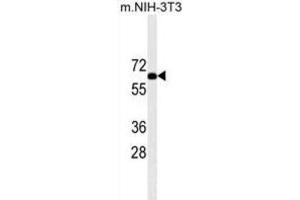 Western Blotting (WB) image for anti-Ribosomal Protein S6 Kinase, 70kDa, Polypeptide 2 (RPS6KB2) antibody (ABIN2909954) (RPS6KB2 anticorps)