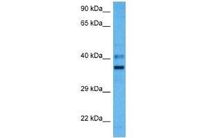 Host:  Mouse  Target Name:  PARD6A  Sample Tissue:  Mouse Liver  Antibody Dilution:  1ug/ml (PARD6A anticorps  (N-Term))