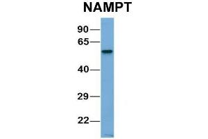 Host:  Rabbit  Target Name:  CHAD  Sample Type:  Human Adult Placenta  Antibody Dilution:  1. (NAMPT anticorps  (C-Term))