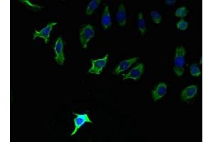 Immunofluorescent analysis of A549 cells using ABIN7163353 at dilution of 1:100 and Alexa Fluor 488-congugated AffiniPure Goat Anti-Rabbit IgG(H+L)