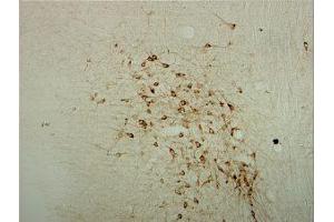 Immunostaining of rat brainstem showing specific labeling using our anti-ChAT antibody. (Choline Acetyltransferase anticorps)