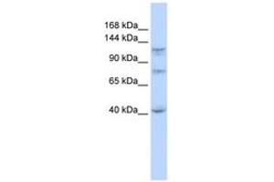 Image no. 1 for anti-DEAH (Asp-Glu-Ala-His) Box Polypeptide 30 (DHX30) (N-Term) antibody (ABIN6742683) (DHX30 anticorps  (N-Term))