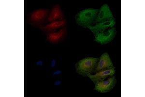 ABIN6258500 and ABIN6274589 staining  cells by IF/ICC. (ARRDC3 anticorps  (C-Term))