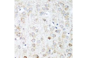 Immunohistochemistry of paraffin-embedded mouse brain using ANKRD52 antibody.