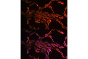 Immunofluorescence analysis of NIH-3T3 cells using P antibody (ABIN7269144).