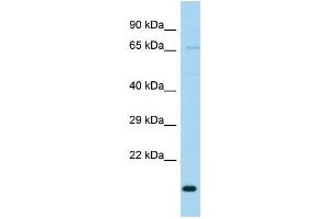 WB Suggested Anti-TIMM23B Antibody Titration: 1. (TIMM23B anticorps  (N-Term))