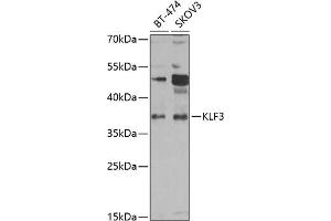 Western blot analysis of extracts of various cell lines, using KLF3 antibody (ABIN6130892, ABIN6142918, ABIN6142919 and ABIN6223018) at 1:1000 dilution. (KLF3 anticorps  (AA 1-240))