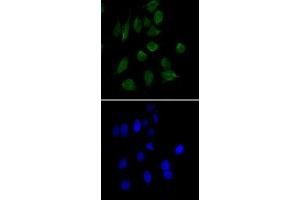 Immunofluorescence analysis of HeLa cells using CHD3 monoclonal antibody, clone 2G4  (green). (CHD3 anticorps)
