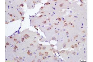 Formalin-fixed and paraffin embedded rat brain labeled with Rabbit Anti-Ceramide synthase 2 Polyclonal Antibody, Unconjugated  at 1:200 followed by conjugation to the secondary antibody and DAB staining