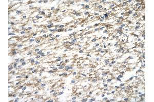 Rabbit Anti-PAntibody       Paraffin Embedded Tissue:  Human cardiac cell   Cellular Data:  Epithelial cells of renal tubule  Antibody Concentration:   4. (PARP12 anticorps  (Middle Region))