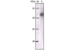 Western blot analysis using CK mouse mAb against truncated CK5 recombinant protein. (pan Keratin anticorps)