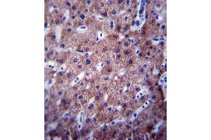 CYP2C19 Antibody (Center) (ABIN390665 and ABIN2840960) immunohistochemistry analysis in formalin fixed and paraffin embedded human liver tissue followed by peroxidase conjugation of the secondary antibody and DAB staining. (CYP2C19 anticorps  (AA 257-285))
