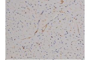 ABIN6267510 at 1/200 staining Mouse heart tissue sections by IHC-P. (STAT6 anticorps  (pTyr641))