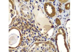 Immunohistochemistry of paraffin-embedded Human kidney using NME2 Polyclonal Antibody at dilution of 1:100 (40x lens). (NME2 anticorps)