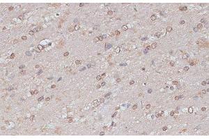 Immunohistochemistry of paraffin-embedded Mouse brain using TLK1 Polyclonal Antibody at dilution of 1:100 (40x lens). (TLK1 anticorps)