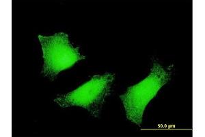 Immunofluorescence of monoclonal antibody to TGM2 on HeLa cell.