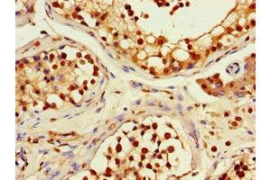 Immunohistochemistry of paraffin-embedded human testis tissue using ABIN7167735 at dilution of 1:100 (RFPL4B anticorps  (AA 1-263))