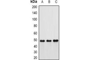 Western blot analysis of Hippi expression in MCF7 (A), mouse kidney (B), rat lung (C) whole cell lysates. (IFT57 anticorps)