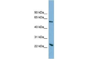 WB Suggested Anti-TMEM161A Antibody Titration:  0. (TMEM161A anticorps  (Middle Region))