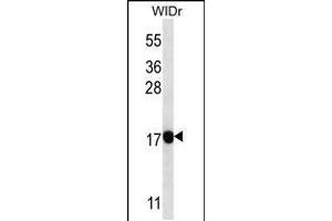 Western blot analysis in WiDr cell line lysates (35ug/lane). (PAEP anticorps  (AA 73-101))